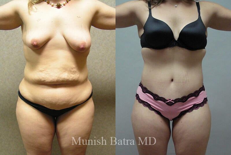 Before and After Image