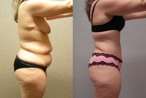 Before and After Image