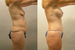 Before and After Image