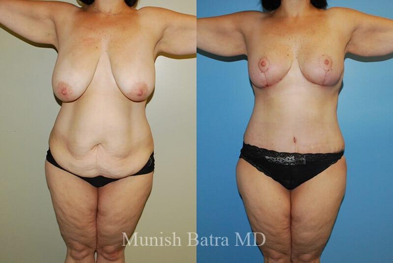Before and After Image