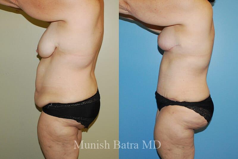 Before and After Image