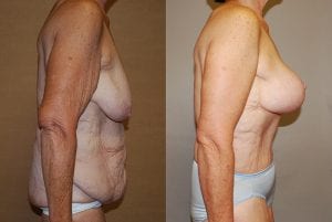 Before and After Image