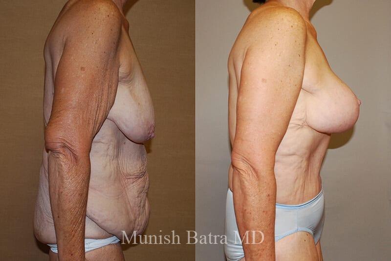 Before and After Image