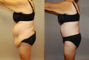 Before and After Image