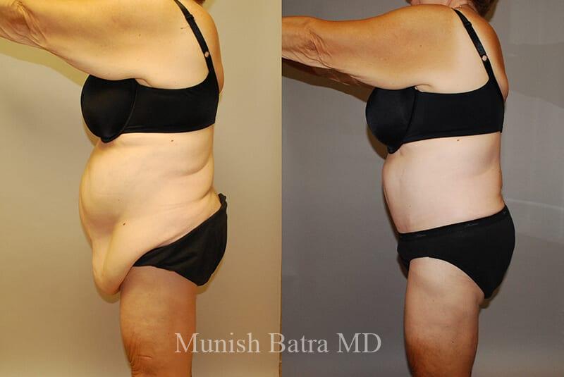 Before and After Image