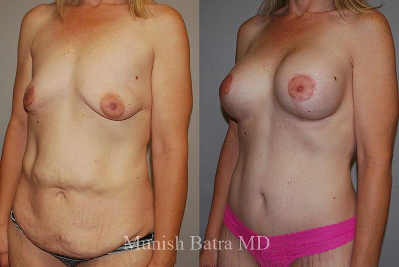 Before and After Image