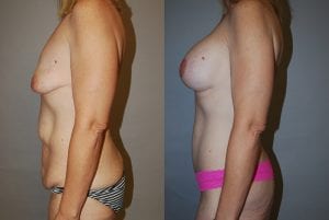 Before and After Image