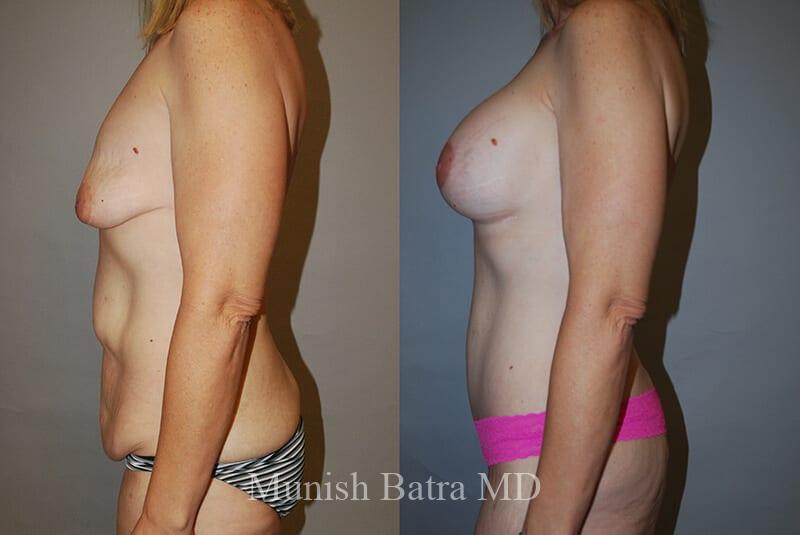 Before and After Image