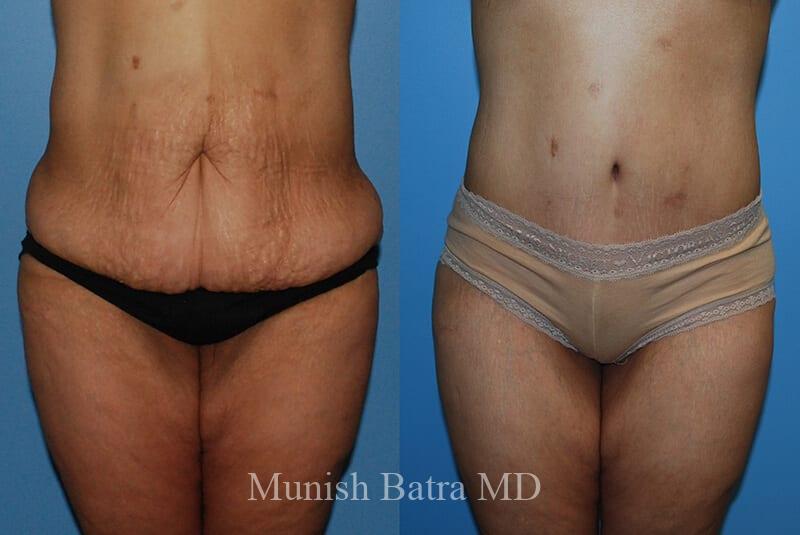 Before and After Image