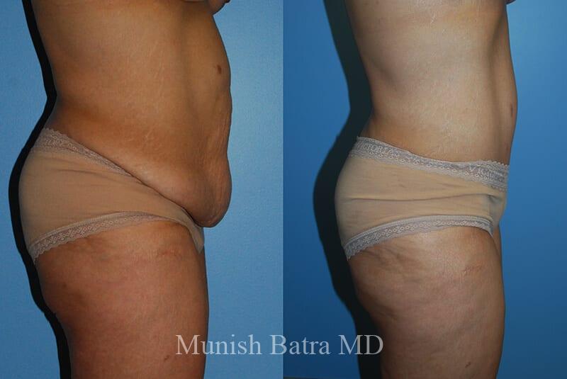 Before and After Image