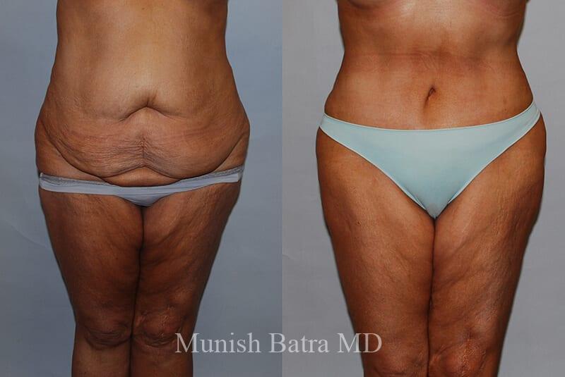 Before and After Image