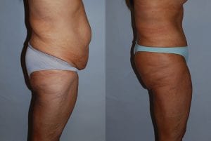 Before and After Image