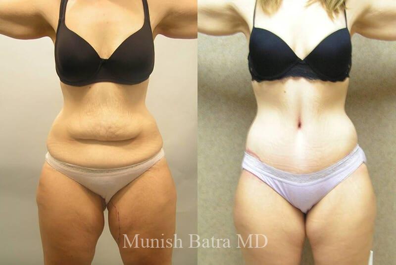 Before and After Image