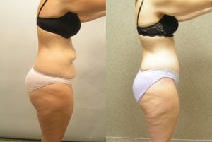 Before and After Image