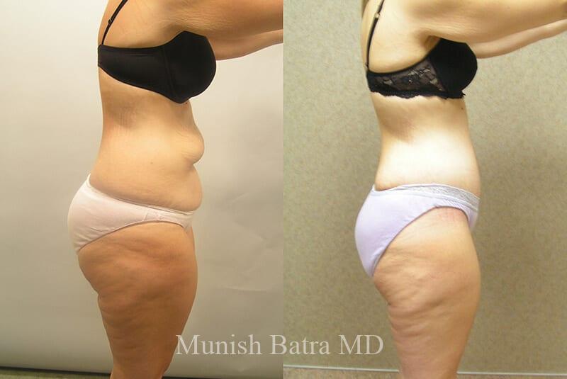 Before and After Image