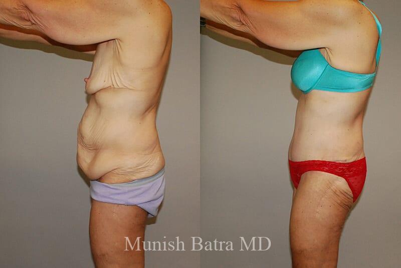Before and After Image