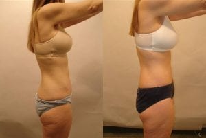 Before and After Image