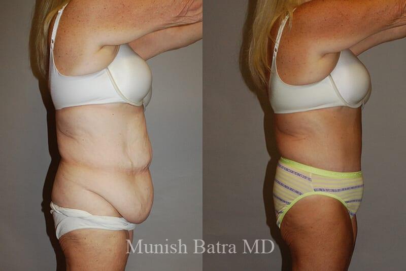 Before and After Image