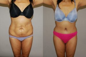 Before and After Image