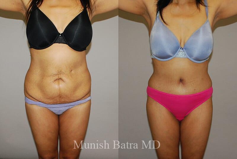 Before and After Image