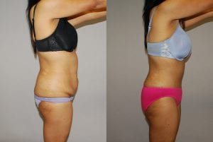 Before and After Image