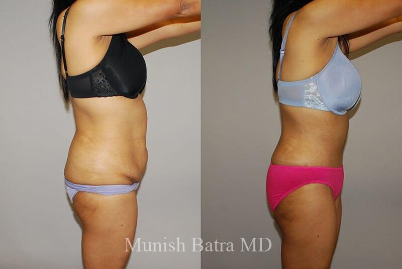 Before and After Image