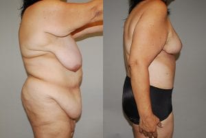 Before and After Image