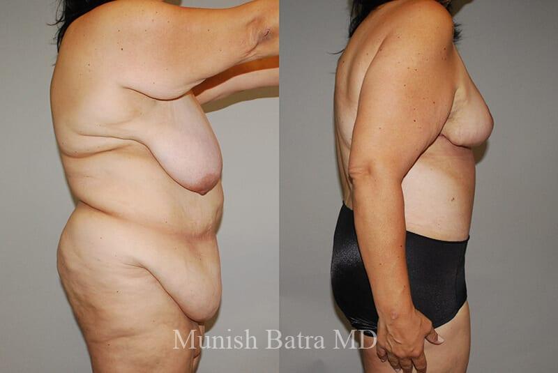 Before and After Image