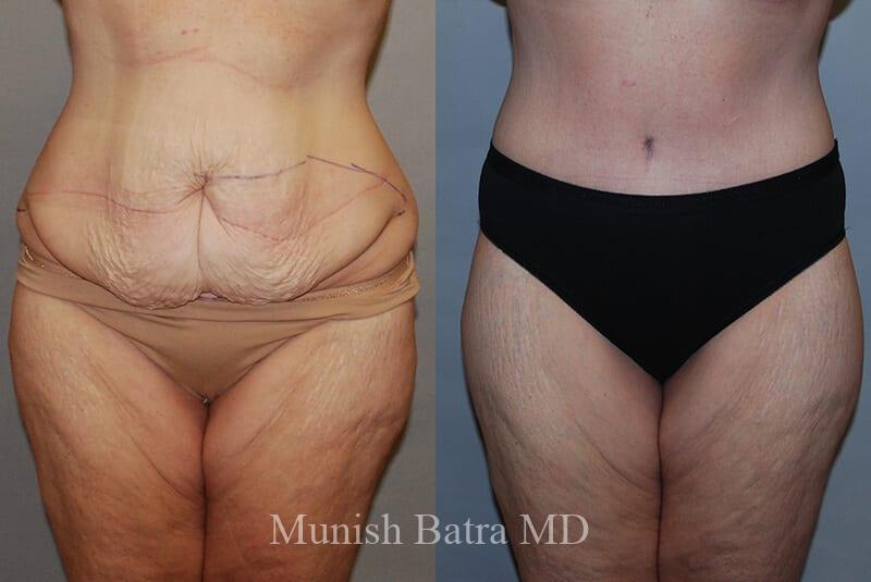 Before and After Image
