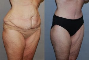 Before and After Image