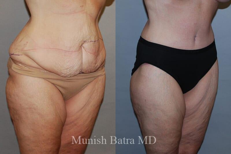 Before and After Image