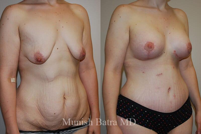 Before and After Image