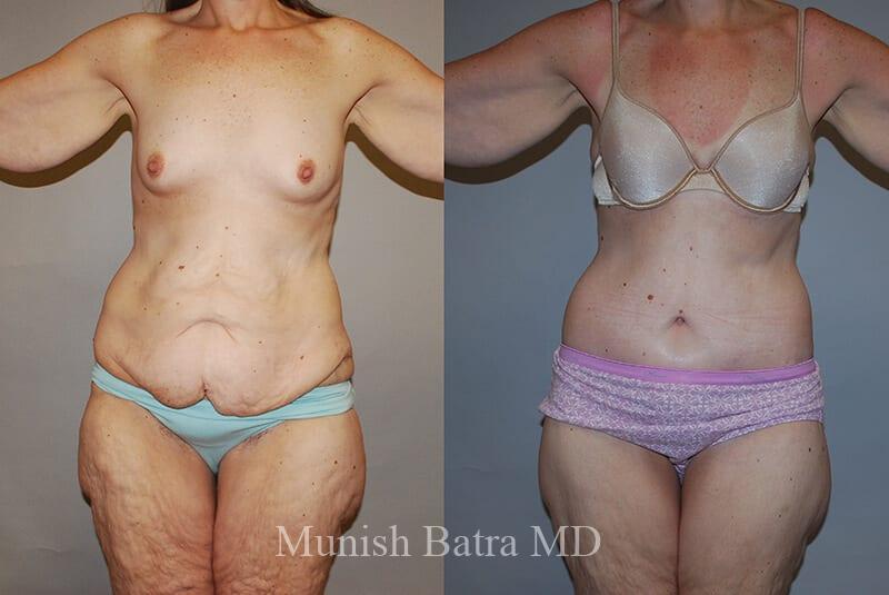 Before and After Image