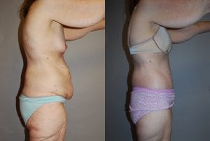 Before and After Image