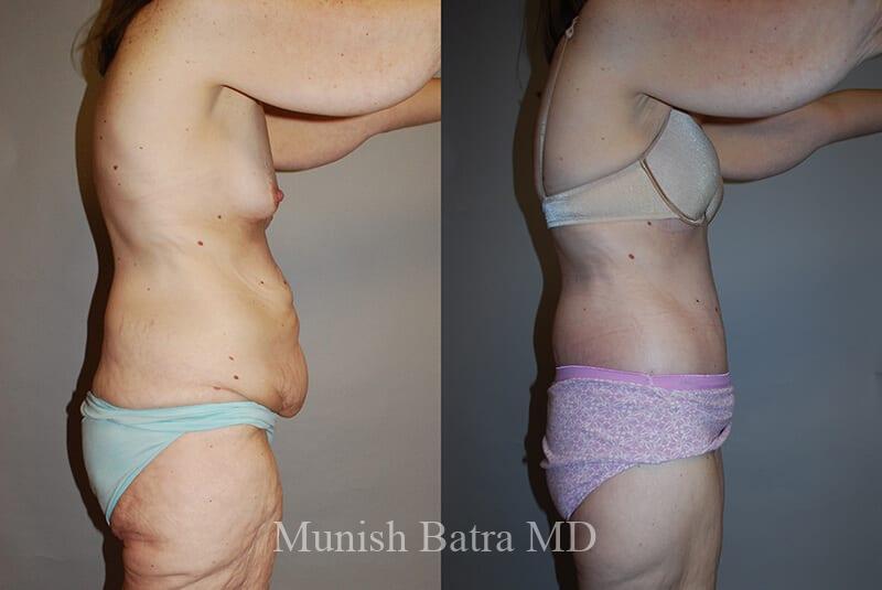 Before and After Image