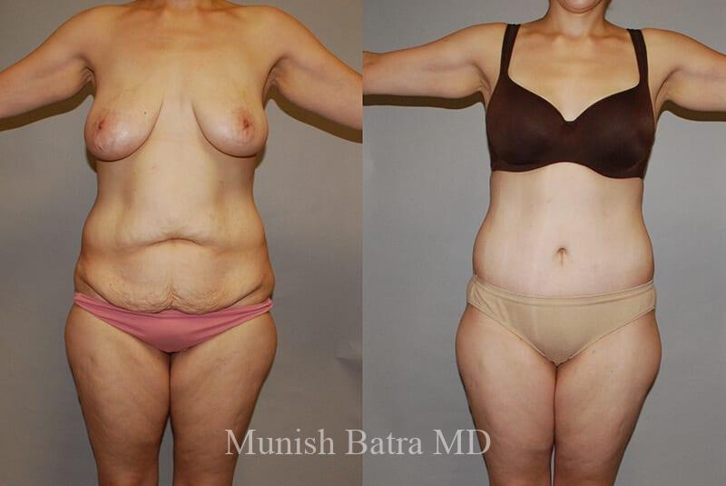 Before and After Image