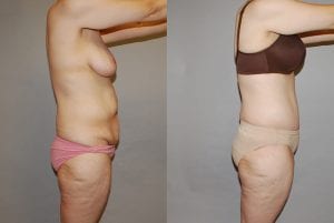 Before and After Image