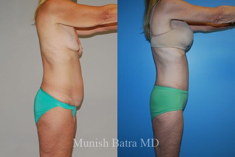 Before and After Image