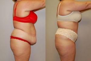 Before and After Image