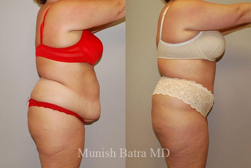 Before and After Image