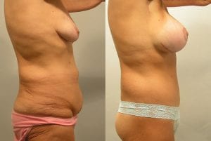 Before and After Image