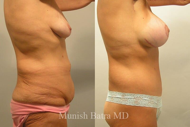 Before and After Image