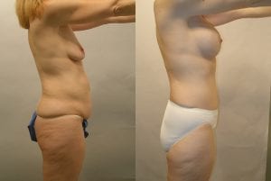 Before and After Image