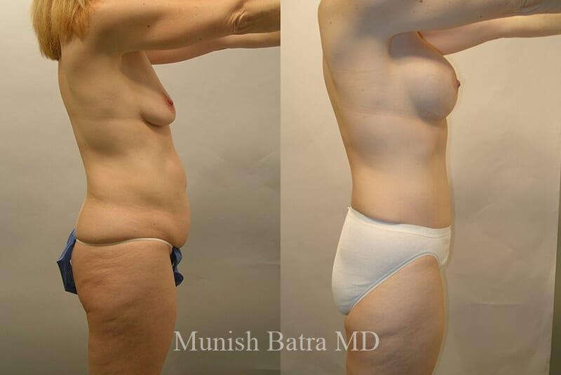 Before and After Image