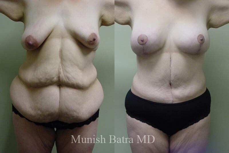 Before and After Image