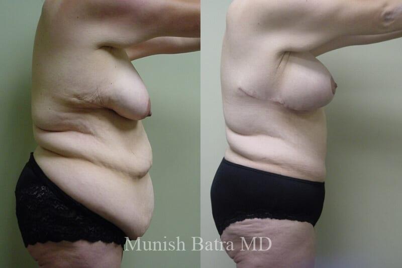 Before and After Image