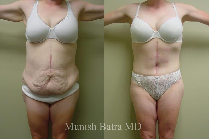 Before and After Image
