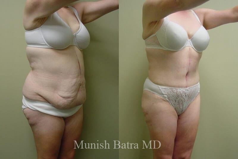 Before and After Image