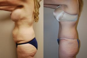 Before and After Image