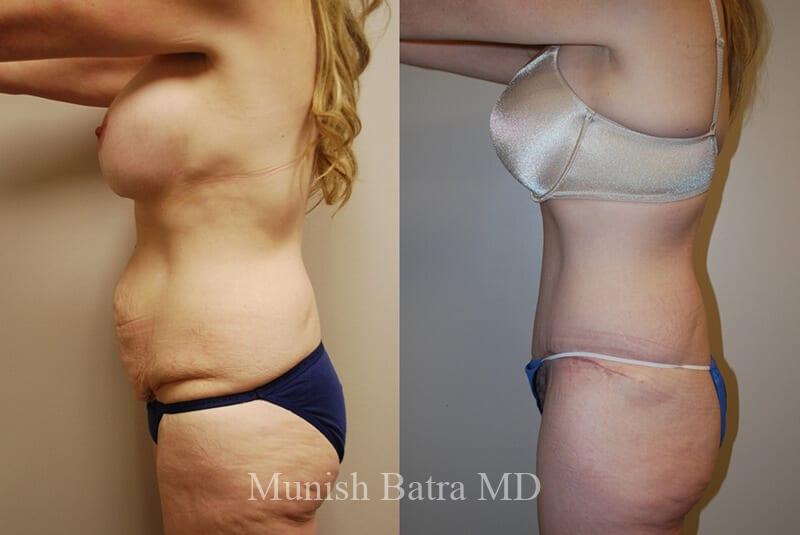 Before and After Image